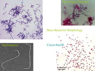 Spirochaetes Cocco-bacilli Branching Filaments Branching Rods More Bacterial Morphology 
