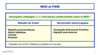 Claude EUGÈNE
MICI et FOIE
13
Principales étiologies (3/3) : Prévalence préférentielle selon la MICI *
Maladie de Crohn Rectocolite hémorragique
Hépatite granulomateuse
Abcès hépatique
Lithiase
Amylose
Cholangite Sclérosante Primitive
Hépatite auto-immune
* Restellini Liver Int 2017 (Référence complète en fin de topo)
 