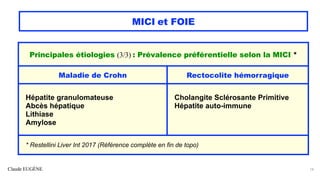 Claude EUGÈNE
MICI et FOIE
14
Principales étiologies (3/3) : Prévalence préférentielle selon la MICI *
Maladie de Crohn Rectocolite hémorragique
Hépatite granulomateuse
Abcès hépatique
Lithiase
Amylose
Cholangite Sclérosante Primitive
Hépatite auto-immune
* Restellini Liver Int 2017 (Référence complète en fin de topo)
 