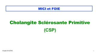 Claude EUGÈNE
MICI et FOIE
Cholangite Sclérosante Primitive
(CSP)
15
 