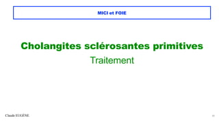 Claude EUGÈNE
MICI et FOIE
Cholangites sclérosantes primitives
Traitement
30
 