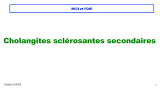 Claude EUGÈNE
MICI et FOIE
Cholangites sclérosantes secondaires
38
 