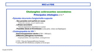 Claude EUGÈNE
MICI et FOIE
Cholangites sclérosantes secondaires
Principales étiologies (1/5) *
- Épisodes récurrents d'angiocholite suppurée
. Des parasites sont parfois en cause
Clonorchis sinensis, ascaris lumbricoides
. Lithiase secondaire
Souvent pigmentaire, hyperdense au scanner
. Possibles abcès et thromboses (veine porte, veines sus-hépatiques)
- Cholangiopathie du VIH 1)
. Immunosuppression sévère (CD4 < 100/mm3)
. Différents pathogènes incriminés:
Cryptosporidium, microsporidium, cytomegalovirus
1) VIH = Virus de l'immunodéficience humaine.
* Ludwig DR 2023 (Référence complète en fin de topo)
40
 