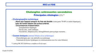 Claude EUGÈNE
MICI et FOIE
Cholangites sclérosantes secondaires
Principales étiologies (5/5) *
- Cholangiopathie ischémique
. Alors que l'apport sanguin du foie est double (veine porte 70-80% et artère hépatique),
celui de l'arbre biliaire est surtout artériel.
. Circonstances d'observation
. Transplantation hépatique
. État de choc, arrêt cardiaque
. Vascularites, drépanocytose, hémoglobinurie paroxystique nocturne...
- Causes toxiques (atteinte biliaire et/ou ischémique)
. Chimiothérapies par voie artérielle ou systémique
. Traitement de kystes hydatiques (si communication avec les voies biliaires)
* Ludwig DR 2023 (Référence complète en fin de topo)
45
 