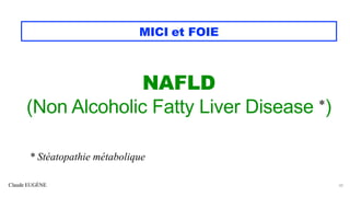 Claude EUGÈNE
MICI et FOIE
NAFLD
(Non Alcoholic Fatty Liver Disease *)
50
* Stéatopathie métabolique
 