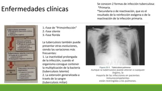 Aunque la tuberculosis puede afectar a cualquier
órgano, la
mayoría de las infecciones en pacientes
inmunocompetentes
están restringidas a los pulmones.
Enfermedades clínicas
1.-Fase de "Primoinfección“
2.-Fase silente
3.-Fase florida
La tuberculosis también puede
presentar otras evoluciones,
siendo las variaciones más
frecuentes:
1. La inactividad prolongada
de la infección, cuando el
organismo consigue contener
la multiplicación de la bacteria
(tuberculosis latente)
2. La extensión generalizada a
través de la sangre
(tuberculosis miliar)
Se conocen 2 formas de infección tuberculosa:
*Primaria.
*Secundaria o de reactivación, que es el
resultado de la reinfección exógena o de la
reactivación de la infección primaria.
 