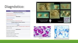 Diagnóstico:
 