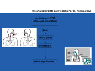 Alveolo pulmonar
Historia Natural De La Infección Por M. Tuberculosis
paciente con TBC
Infecciosa (bacilífera)
tos
micro gotas
inhalación
 