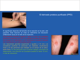 El derivado proteico purificado (PPD)
El significado depende del tamaño de la reacción en la piel y del
paciente. Esta reacción se mide en milímetros de induración
(inflamación dura) en el sitio de la inyección.
Una pequeña reacción (superior o igual a 5 mm.) se considera
positiva en personas con VIH, en quienes se están sometiendo a
una terapia con esteroides o en individuos en contacto cercano
con una persona con tuberculosis activa.
Las reacciones grandes (superiores o iguales a 10 mm.) se
consideran positivas en personas con diabetes, insuficiencia
renal y en las personas que trabajan en el campo de la salud,
entre otros. En las personas que no tienen riesgos conocidos de
tuberculosis, una reacción se considera positiva si tiene 15 mm.
o más de induración.
 