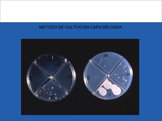 METODO DE CULTIVO EN CAPA DELGADA
 