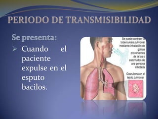  Cuando     el
  paciente
  expulse en el
  esputo
  bacilos.
 