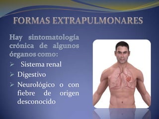  Sistema renal
 Digestivo
 Neurológico o con
  fiebre de origen
  desconocido
 