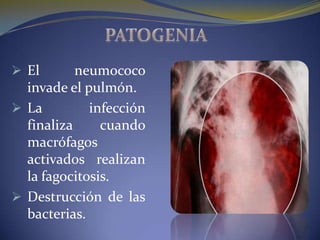  El       neumococo
  invade el pulmón.
 La         infección
  finaliza     cuando
  macrófagos
  activados realizan
  la fagocitosis.
 Destrucción de las
  bacterias.
 