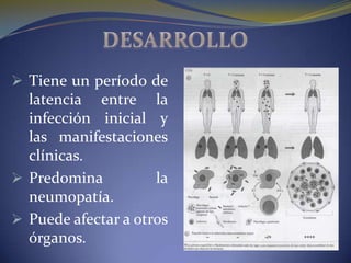  Tiene un período de
  latencia entre la
  infección inicial y
  las manifestaciones
  clínicas.
 Predomina          la
  neumopatía.
 Puede afectar a otros
  órganos.
 