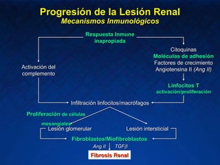Progresión de la Lesión Renal Mecanismos Inmunológicos Respuesta Inmune inapropiada Infiltración linfocitos/macrófagos Linfocitos T activación/proliferación Lesión intersticial Lesión glomerular Fibroblastos/Miofibroblastos Fibrosis Renal Proliferación  de células  mesangiales Ang II TGF  Activación del complemento Citoquinas Moléculas de adhesión Factores de crecimiento Angiotensina II  (Ang II) 