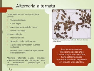 Alternaria alternata
Característicasmacroscópicasde la
colonia:
🠶 Tamaño ilimitado
🠶 Color negro
🠶 Aspecto aterciopelado y seco
🠶 Forma aplanada
Micro morfología:
🠶 Macrosifonado
🠶 Septado y color café oscuro
🠶 Algunas cepasmuestran cuerpos
nodulares
🠶 Reproduccion anamórfica por medio
de dictioconidios.
Alternaria alternata puede provocar
lesiones cutáneas y subcutáneas, es causa
de endoftalmitis posquirúrgica y
onicomicosis.
Lasonicomicosisson
infeccionesde lasuñas
causadaspor dermatofitos,
hongosfilamentosos
encontradoscomo saprobios
en el suelo y lasplantas.
Morfología microscópica de un cultivo de Alternaria alternata.
(udea.edu.co)
 