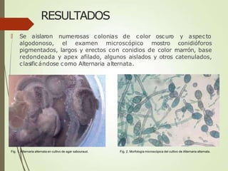 RESULTADOS
🠶 Se aislaron numerosas colonias de color oscuro y aspecto
algodonoso, el examen microscópico mostro conidióforos
pigmentados, largos y erectos con conidios de color marrón, base
redondeada y apex afilado, algunos aislados y otros catenulados,
clasificándose como Alternaria alternata.
Fig. 1. Alternaria alternata en cultivo de agar sabouraud. Fig. 2. Morfología microscópica del cultivo de Alternaria alternata.
 