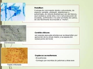 Penicillium
Colonias de crecimiento rápido y abundante, de
aspecto variable, afelpado, algodonoso o
pulverizado, de colores diversos que van del blanco,
azul-verdoso a verde olivo. Con o sin producción de
exudado, confiriendo o no color al medio de cultivo,
de olorfácilmente reconocible a “moho”.
Candida albicans
son esporas asexuales simples que se desarrollan por
gemación de la célula madre, y su separación
subsecuente del brote
Cryptococcusneoformans
- En pulmones
-Contagio por excretas de palomas y otras aves
 