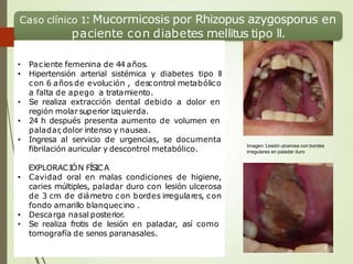 Caso clínico 1: Mucormicosis por Rhizopus azygosporus en
paciente con diabetes mellitus tipo ll.
• Paciente femenina de 44 años.
• Hipertensión arterial sistémica y diabetes tipo ll
con 6 años de evolución , descontrol metabólico
a falta de apego a tratamiento.
• Se realiza extracción dental debido a dolor en
región molarsuperior izquierda.
• 24 h después presenta aumento de volumen en
paladar
,dolor intenso y nausea.
• Ingresa al servicio de urgencias, se documenta
fibrilación auricular y descontrol metabólico.
EXPLORACIÓN FÍSICA
• Cavidad oral en malas condiciones de higiene,
caries múltiples, paladar duro con lesión ulcerosa
de 3 cm de diámetro con bordes irregulares, con
fondo amarillo blanquecino .
• Descarga nasal posterior.
• Se realiza frotis de lesión en paladar, así como
tomografía de senos paranasales.
Imagen: Lesión ulcerosa con bordes
irregulares en paladar duro
 