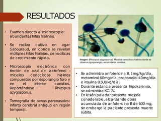 RESULTADOS
• Examen directo al microscopio:
abundanteshifas hialinas.
• Se realiza cultivo en agar
Sabouraud, en donde se revelan
múltiples hifas hialinas, cenocíticas
de crecimiento rápido.
• Microscopía electrónica con
tinción de azul de lactofenol :
micelios cenocíticos hialinos
compuestos por esporangio foro y
en el interior conidios.
Rhizopus
Reportándose
azygosporus.
• Tomografía de senos paranasales:
infarto cerebral antiguo en región
temporal.
• Se administra anfotericina B, 1mg/kg/día,
metamizol 60mg/día, propanolol 40mg/día
e insulina 0.5UI/kg/día.
• Durante estancia presenta hipokalemia,
se administra KCl IV.
• En lesión paladarpresenta mejoría
considerable, alcanzando dosis
acumulada de anfotericina B de 630 mg;
sin embargo la paciente presenta muerte
súbita.
Imagen: (Rhizopus azygosporus). Micelios cenocíticos hialinos donde se
observa zigosporangio y en el interior conidios.
 