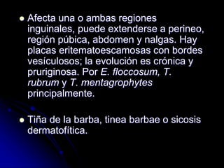  Afecta una o ambas regiones 
inguinales, puede extenderse a perineo, 
región púbica, abdomen y nalgas. Hay 
placas eritematoescamosas con bordes 
vesículosos; la evolución es crónica y 
pruriginosa. Por E. floccosum, T. 
rubrum y T. mentagrophytes 
principalmente. 
 Tiña de la barba, tinea barbae o sicosis 
dermatofítica. 
 