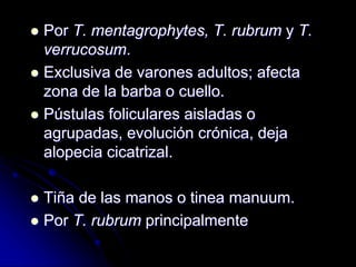  Por T. mentagrophytes, T. rubrum y T. 
verrucosum. 
 Exclusiva de varones adultos; afecta 
zona de la barba o cuello. 
 Pústulas foliculares aisladas o 
agrupadas, evolución crónica, deja 
alopecia cicatrizal. 
 Tiña de las manos o tinea manuum. 
 Por T. rubrum principalmente 
 