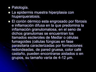  Patología. 
 La epidermis muestra hiperplasia con 
hiuperqueratosis. 
 El corión dérmico esta engrosado por fibrosis 
e inflamación difusa en la que predomina la 
inflamación granulomatosa, en el seno de 
dichos granulomas se encuentran los 
llamados esclerotes de Medlar o células 
fumagoides (células fúngicas en fase 
parasitaria caracterizadas por formaciones 
redondeadas, de pared gruesa, color café 
castaño, pueden encontrarse aislados o en 
grupos, su tamaño varía de 4-12 μm. 
 