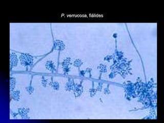 P. verrucosa, fiálides 
 