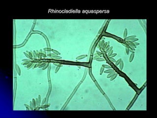 Rhinocladiella aquaspersa 
 