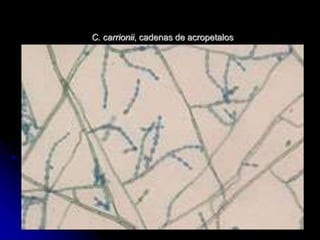 C. carrionii, cadenas de acropetalos 
 