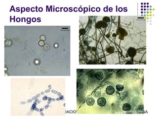 Aspecto Microscópico de los
Hongos




          FUNDACION BARCELO FACULTAD DE MEDICINA
 