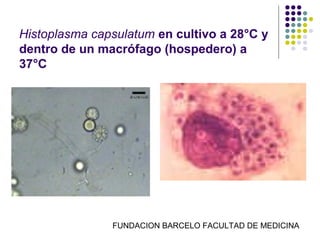 Histoplasma capsulatum en cultivo a 28°C y
dentro de un macrófago (hospedero) a
37°C




               FUNDACION BARCELO FACULTAD DE MEDICINA
 