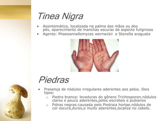 Tinea Nigra
• Assintomática, localizada na palma das mãos ou dos
pés, aparecimento de manchas escuras de aspecto fuliginoso
• Agente: Phaeoannellomyces wernwckii e Stenella araguata
Piedras
• Presença de nódulos irregulares aderentes aos pelos. Dois
tipos:
o Piedra branca: leveduras do gênero Trichosporon,nódulos
claros e pouco aderentes,pelos escrotais e pubianos
o Pidras negras:causada pelo Piedraia hortae,nódulos de
cor escura,duros,e muito aderentes,localiza no cabelo.
 