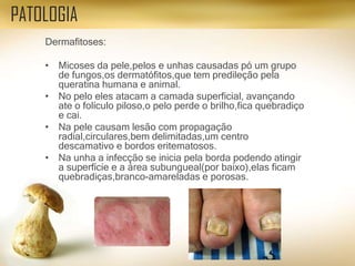 Dermafitoses:
• Micoses da pele,pelos e unhas causadas pó um grupo
de fungos,os dermatófitos,que tem predileção pela
queratina humana e animal.
• No pelo eles atacam a camada superficial, avançando
ate o folículo piloso,o pelo perde o brilho,fica quebradiço
e cai.
• Na pele causam lesão com propagação
radial,circulares,bem delimitadas,um centro
descamativo e bordos eritematosos.
• Na unha a infecção se inicia pela borda podendo atingir
a superfície e a área subungueal(por baixo),elas ficam
quebradiças,branco-amareladas e porosas.
PATOLOGIA
 