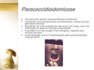 Paracoccidioidomicose
• Causada pelo agente paracoccidioides brasiliensis
• Conhecida como blastomicose sul-americana, micose de lutz-
splendore-almeida.
• Resultante de uma inalação de estruturas do fungo, como da
reativação de alguma infecção preexistente.
• O pulmão é um dos órgãos mais atingidos, seguido pela
mucosa da boca.
• A manifestação grave é representada pela paracoccidioides
“tipo junvenil”.
 