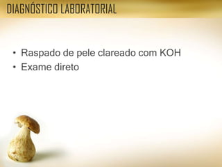 • Raspado de pele clareado com KOH
• Exame direto
DIAGNÓSTICO LABORATORIAL
 