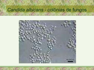 Candida albicans -  colônias de fungos 