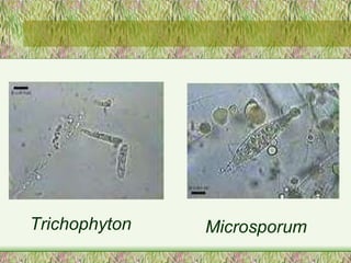 Trichophyton Microsporum 