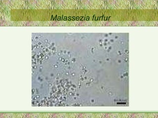 Malassezia furfur 