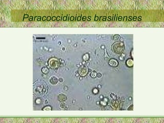 Paracoccidioides brasilienses 