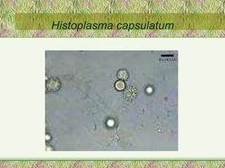 Histoplasma capsulatum 