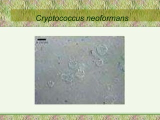 Cryptococcus neoformans 