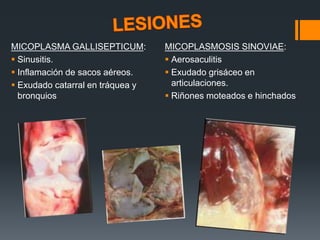 MICOPLASMA GALLISEPTICUM: 
 Sinusitis. 
 Inflamación de sacos aéreos. 
 Exudado catarral en tráquea y 
bronquios 
MICOPLASMOSIS SINOVIAE: 
 Aerosaculitis 
 Exudado grisáceo en 
articulaciones. 
 Riñones moteados e hinchados 
 