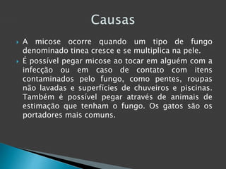  A micose ocorre quando um tipo de fungo 
denominado tinea cresce e se multiplica na pele. 
 É possível pegar micose ao tocar em alguém com a 
infecção ou em caso de contato com itens 
contaminados pelo fungo, como pentes, roupas 
não lavadas e superfícies de chuveiros e piscinas. 
Também é possível pegar através de animais de 
estimação que tenham o fungo. Os gatos são os 
portadores mais comuns. 
 