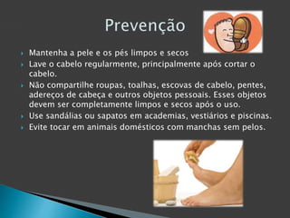  Mantenha a pele e os pés limpos e secos 
 Lave o cabelo regularmente, principalmente após cortar o 
cabelo. 
 Não compartilhe roupas, toalhas, escovas de cabelo, pentes, 
adereços de cabeça e outros objetos pessoais. Esses objetos 
devem ser completamente limpos e secos após o uso. 
 Use sandálias ou sapatos em academias, vestiários e piscinas. 
 Evite tocar em animais domésticos com manchas sem pelos. 
