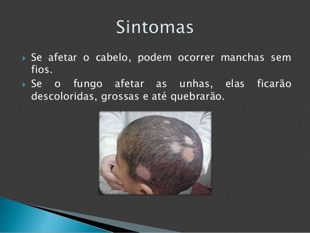 De umas soluções de fungo de pé