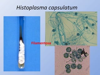 Histoplasma capsulatum
Filamentosa
 