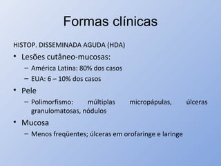 Formas clínicas
HISTOP. DISSEMINADA AGUDA (HDA)
• Lesões cutâneo-mucosas:
– América Latina: 80% dos casos
– EUA: 6 – 10% dos casos
• Pele
– Polimorfismo: múltiplas micropápulas, úlceras
granulomatosas, nódulos
• Mucosa
– Menos freqüentes; úlceras em orofaringe e laringe
 