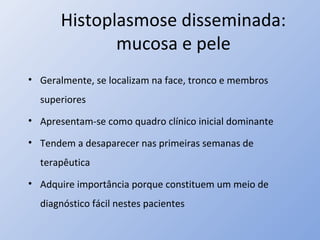 Histoplasmose disseminada:
mucosa e pele
• Geralmente, se localizam na face, tronco e membros
superiores
• Apresentam-se como quadro clínico inicial dominante
• Tendem a desaparecer nas primeiras semanas de
terapêutica
• Adquire importância porque constituem um meio de
diagnóstico fácil nestes pacientes
 