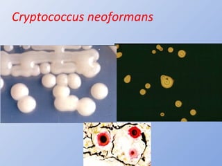 Cryptococcus neoformans
 